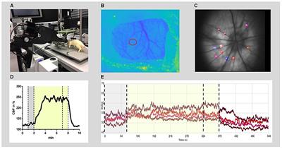 Vascular Reactivity to Hypercapnia Is Impaired in the Cerebral and Retinal Vasculature in the Acute Phase After Experimental Subarachnoid Hemorrhage